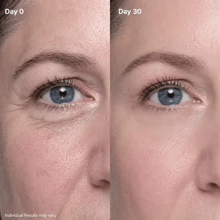 🔥Final 2 Hour 50% OFF🔥 LOVILDS Eye Renewal Cream