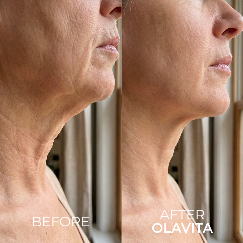 The Korean Needle-Free Botox for Visibly Firmer, Smoother, And More Radiant Skin — Anywhere It Ages