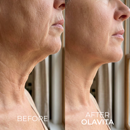 The Korean Needle-Free Botox for Visibly Firmer, Smoother, And More Radiant Skin — Anywhere It Ages
