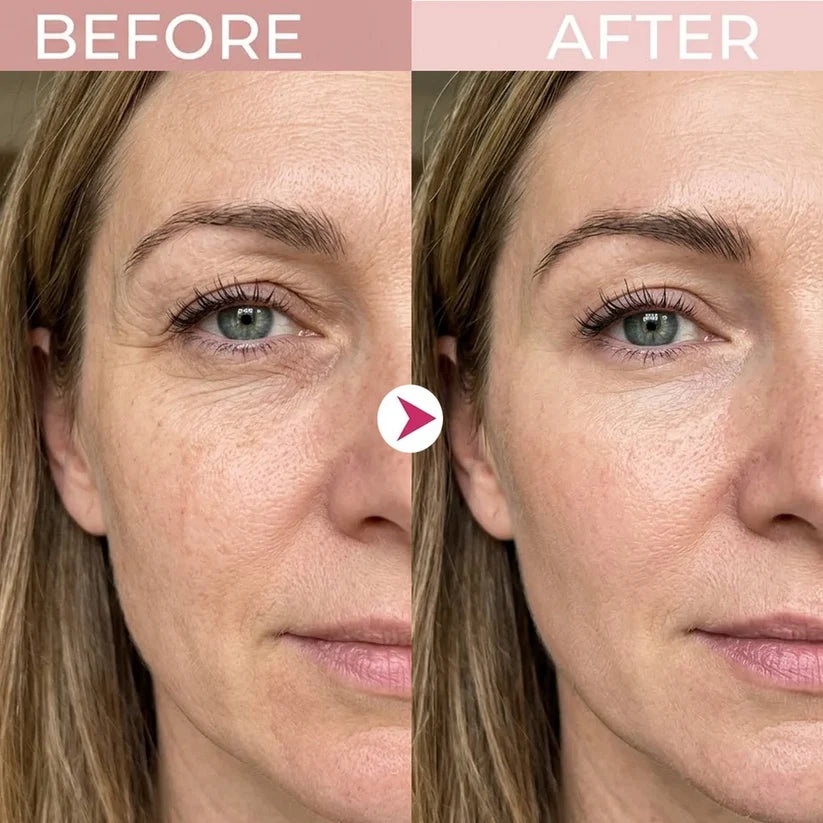 🔥Final 2 Hour 50% OFF🔥 LOVILDS Eye Renewal Cream
