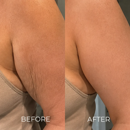 The Korean Needle-Free Botox for Visibly Firmer, Smoother, And More Radiant Skin — Anywhere It Ages
