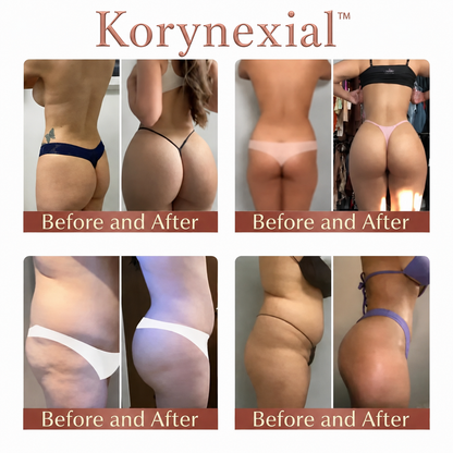 Korynexial™ CurveSculpt Micro-Patch ✦ Sculpt • Firm • Smooth Lower Body Curves ✦ Micro-Needle Infusion System