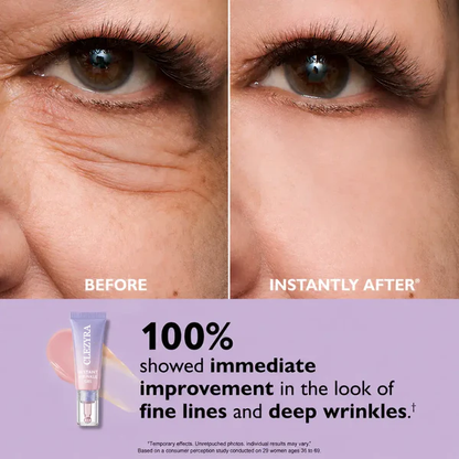 CLEZYRA Eye Bag Instant Eraser, Tightens, Firms, & Blurs Wrinkles