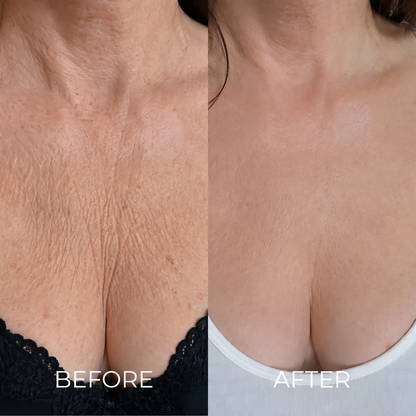 The Korean Needle-Free Botox for Visibly Firmer, Smoother, And More Radiant Skin — Anywhere It Ages