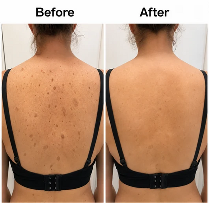 Smooth & Even Glycolic Body Stick