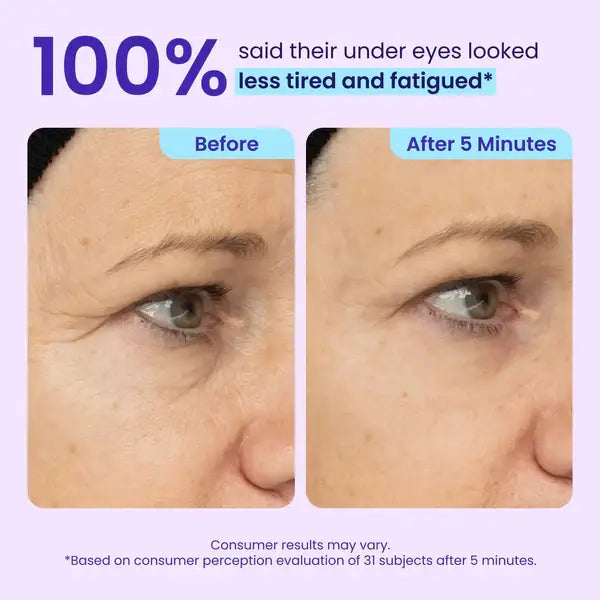 CLEZYRA Eye Bag Instant Eraser, Tightens, Firms, & Blurs Wrinkles