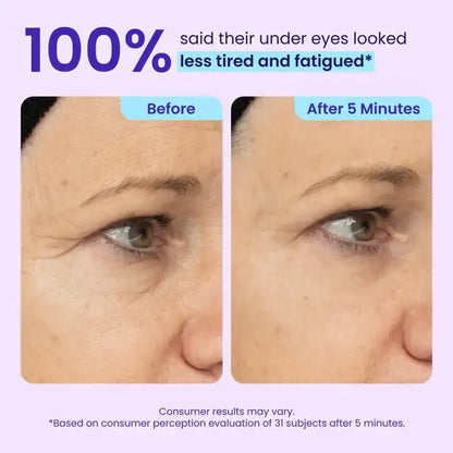CLEZYRA Eye Bag Instant Eraser, Tightens, Firms, & Blurs Wrinkles