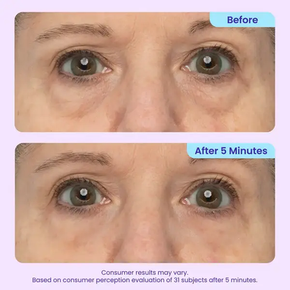 CLEZYRA Eye Bag Instant Eraser, Tightens, Firms, & Blurs Wrinkles