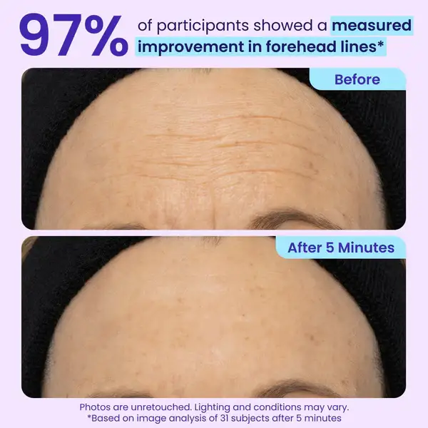 CLEZYRA Eye Bag Instant Eraser, Tightens, Firms, & Blurs Wrinkles