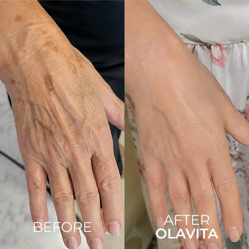 The Korean Needle-Free Botox for Visibly Firmer, Smoother, And More Radiant Skin — Anywhere It Ages