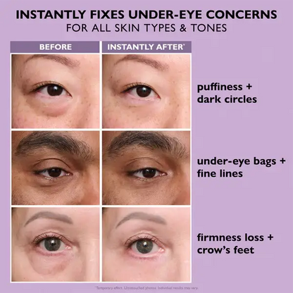 CLEZYRA Eye Bag Instant Eraser, Tightens, Firms, & Blurs Wrinkles
