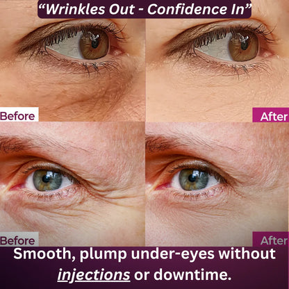 yellowte® Calcium Volume Balm Stick – Lift, Firm & Smooth Wrinkles in Seconds